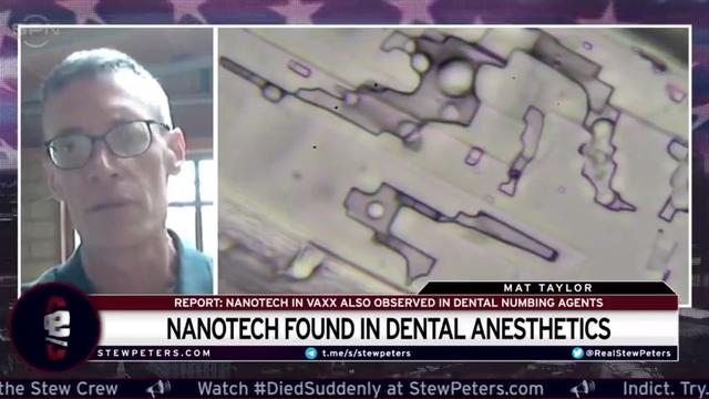 stew peters - nanotech found in dental anesthetics