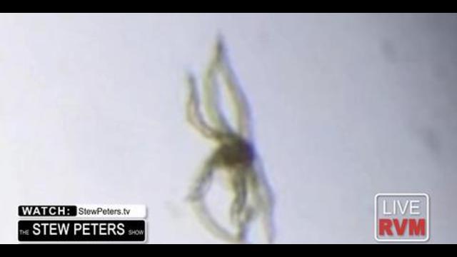 breaking: dr madej finds living “tentacle” organism in vaccine vials