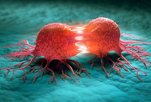 Doctor Says Fast-Growing Tumors In Vaxxed - Fringe News